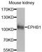 EPH Receptor B1 antibody, STJ110713, St John