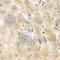 Thymidine Kinase 1 antibody, A5612, ABclonal Technology, Immunohistochemistry paraffin image 