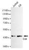C-Terminal Src Kinase antibody, M00799-1, Boster Biological Technology, Western Blot image 