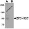 Probable ribonuclease ZC3H12C antibody, 5677, ProSci, Western Blot image 