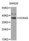 HOXA9 antibody, STJ24072, St John