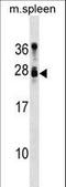 Tumor suppressor candidate gene 1 protein antibody, LS-C158283, Lifespan Biosciences, Western Blot image 