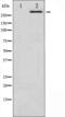 Mechanistic Target Of Rapamycin Kinase antibody, abx010405, Abbexa, Western Blot image 