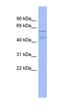 Twinfilin Actin Binding Protein 1 antibody, orb330850, Biorbyt, Western Blot image 