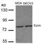 Ezrin antibody, 79-537, ProSci, Western Blot image 