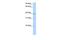 Nudix Hydrolase 17 antibody, GTX46224, GeneTex, Western Blot image 