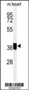 Coiled-Coil Domain Containing 42 antibody, 61-756, ProSci, Western Blot image 