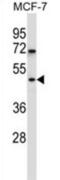 WD Repeat Domain 88 antibody, abx027468, Abbexa, Western Blot image 