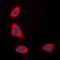TLR11 antibody, orb74537, Biorbyt, Immunocytochemistry image 