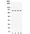 Phosphoinositide-3-Kinase Regulatory Subunit 2 antibody, R31788, NSJ Bioreagents, Western Blot image 