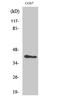 Aurora Kinase B antibody, STJ91692, St John