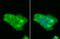 Lipocalin 2 antibody, GTX132936, GeneTex, Immunofluorescence image 