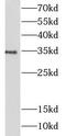 Leukocyte Immunoglobulin Like Receptor A5 antibody, FNab04777, FineTest, Western Blot image 