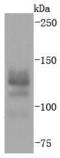 BAF Chromatin Remodeling Complex Subunit BCL11B antibody, A01485, Boster Biological Technology, Western Blot image 