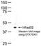 RAD52 Homolog, DNA Repair Protein antibody, GTX70301, GeneTex, Western Blot image 