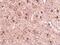 Mitochondrial import receptor subunit TOM70 antibody, PA5-20654, Invitrogen Antibodies, Immunohistochemistry frozen image 