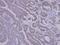 Sorting Nexin 12 antibody, PA5-21774, Invitrogen Antibodies, Immunohistochemistry frozen image 