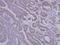 Sorting nexin-12 antibody, PA5-21774, Invitrogen Antibodies, Immunohistochemistry frozen image 