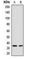 Sodium/potassium-transporting ATPase subunit beta-1 antibody, LS-C668027, Lifespan Biosciences, Western Blot image 