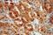 TRNA Methyltransferase 2 Homolog A antibody, 16199-1-AP, Proteintech Group, Immunohistochemistry paraffin image 