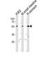 Fyn Related Src Family Tyrosine Kinase antibody, PA5-49385, Invitrogen Antibodies, Western Blot image 