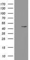 Phosphorylase Kinase Catalytic Subunit Gamma 2 antibody, NBP2-46393, Novus Biologicals, Western Blot image 