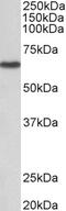 Actin Related Protein 2/3 Complex Subunit 1A antibody, 42-980, ProSci, Western Blot image 