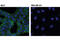 Erb-B2 Receptor Tyrosine Kinase 3 antibody, 12708S, Cell Signaling Technology, Immunocytochemistry image 