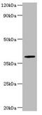 Arylsulfatase B antibody, orb238301, Biorbyt, Western Blot image 