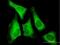 Eukaryotic Translation Initiation Factor 5B antibody, H00009669-B01P, Novus Biologicals, Immunofluorescence image 