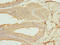 Casein Kinase 1 Gamma 1 antibody, LS-C675596, Lifespan Biosciences, Immunohistochemistry paraffin image 