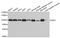 DEAD-Box Helicase 1 antibody, STJ28658, St John