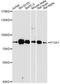 Coagulation Factor XIII A Chain antibody, A1461, ABclonal Technology, Western Blot image 