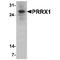 Paired Related Homeobox 1 antibody, TA349141, Origene, Western Blot image 