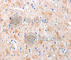 KiSS-1 Metastasis Suppressor antibody, A2987, ABclonal Technology, Immunohistochemistry paraffin image 
