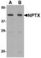 Neuronal Pentraxin 2 antibody, MBS150863, MyBioSource, Western Blot image 