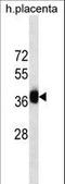 Gastrulation Brain Homeobox 2 antibody, LS-C166402, Lifespan Biosciences, Western Blot image 