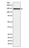 Hypoxia Up-Regulated 1 antibody, M04934-2, Boster Biological Technology, Western Blot image 