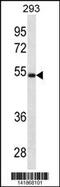 Legumain antibody, 60-798, ProSci, Western Blot image 