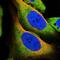 Mucolipin 1 antibody, NBP1-92152, Novus Biologicals, Immunofluorescence image 