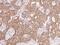 Cell Adhesion Associated, Oncogene Regulated antibody, 106220-T08, Sino Biological, Immunohistochemistry paraffin image 