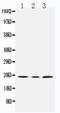 Succinate Dehydrogenase Complex Subunit C antibody, PA1839, Boster Biological Technology, Western Blot image 