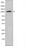 RAB3 GTPase Activating Protein Catalytic Subunit 1 antibody, orb226822, Biorbyt, Western Blot image 