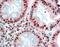 Methyl-CpG Binding Domain Protein 2 antibody, PA5-18619, Invitrogen Antibodies, Immunohistochemistry paraffin image 
