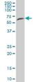 Fibroblast Growth Factor Receptor Substrate 3 antibody, H00010817-B01P, Novus Biologicals, Western Blot image 