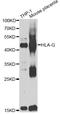 Major Histocompatibility Complex, Class I, G antibody, STJ29695, St John