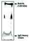 BUB1 Mitotic Checkpoint Serine/Threonine Kinase B antibody, MBS395896, MyBioSource, Western Blot image 