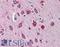 Serpin Family I Member 1 antibody, LS-B6116, Lifespan Biosciences, Immunohistochemistry frozen image 