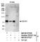 DEAD-Box Helicase 51 antibody, NB100-57526, Novus Biologicals, Western Blot image 