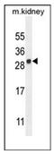 LY6/PLAUR Domain Containing 4 antibody, AP52568PU-N, Origene, Western Blot image 